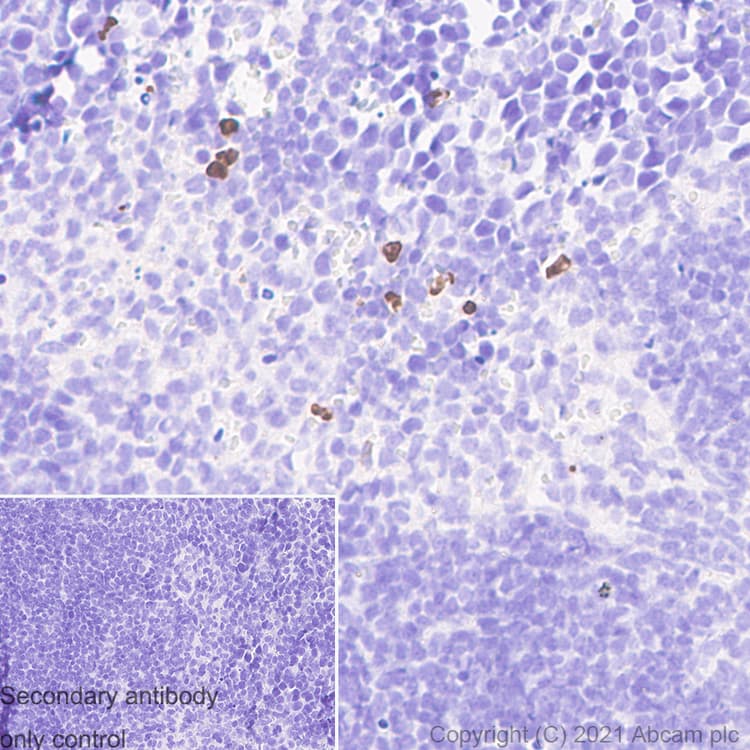 Anti-MMP9 antibody [RM1020](AB283575)
