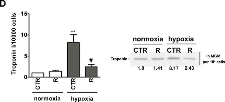 Anti-Cardiac Troponin I antibody [EP1106Y](AB52862)