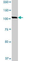 Ipo5 Antibody Ab88695  Western Blot Img147611