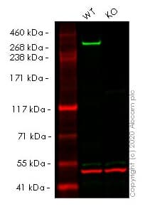 Anti-Huntingtin antibody [EPR5526](AB109115)