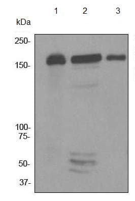 Anti-MSH6 antibody [EPR3945](AB92471)