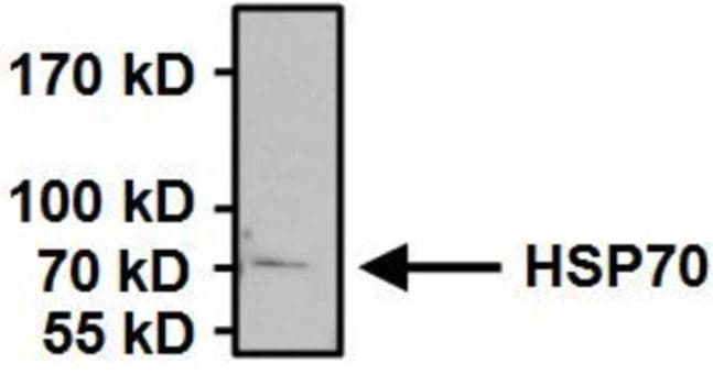 Anti-Hsp70 antibody [5A5](AB2787)