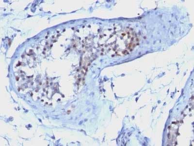 Cyclin B1 Antibody Ccnb1 1098 Ab212977  Immunohistochemistry Formalin Pfa Fixed Paraffin Embedded Sections Img56416