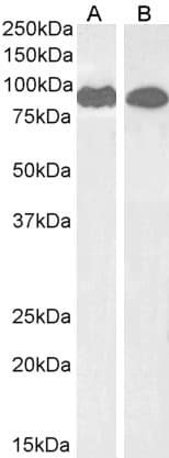Anti-VPS35 antibody(AB10099)