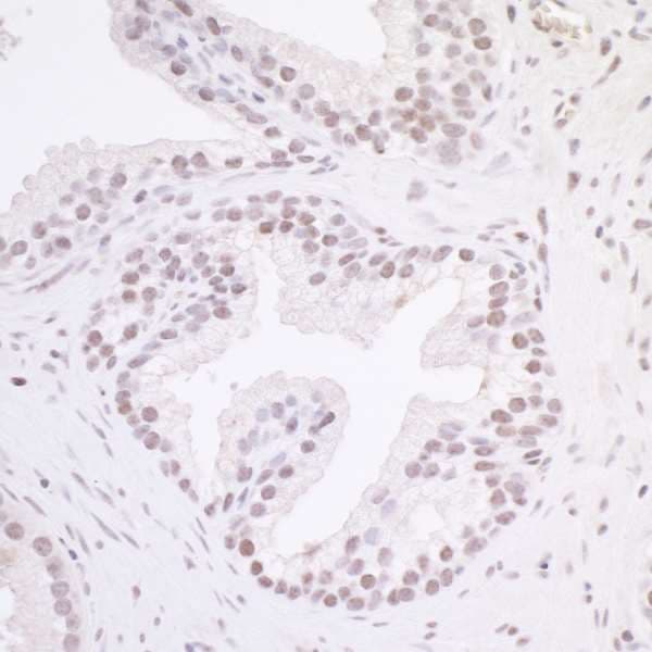 Maz Antibody Ab85725  Immunohistochemistry Formalin Pfa Fixed Paraffin Embedded Sections Img171795