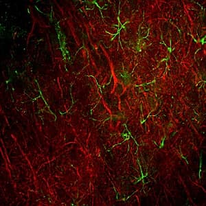 68kda Neurofilament Nf L Antibody Da2 Ab7255  Immunocytochemistry Immunofluorescence Img134568