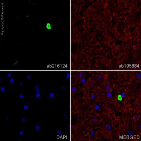 Anti-Alpha-synuclein aggregate antibody [MJFR-14-6-4-2] - Conformation-Specific(AB209538)