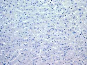 Anti-Myosin light chain 3 antibody [EPR4160] - BSA and Azide free(AB247710)