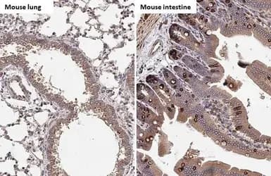 Hck Antibody Hl1673 Ab308234  Immunohistochemistry Paraffin Embedded Sections Img407226