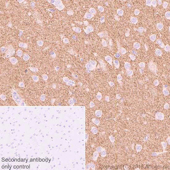 Anti-VGluT1 antibody [EPR22269](ab227805)