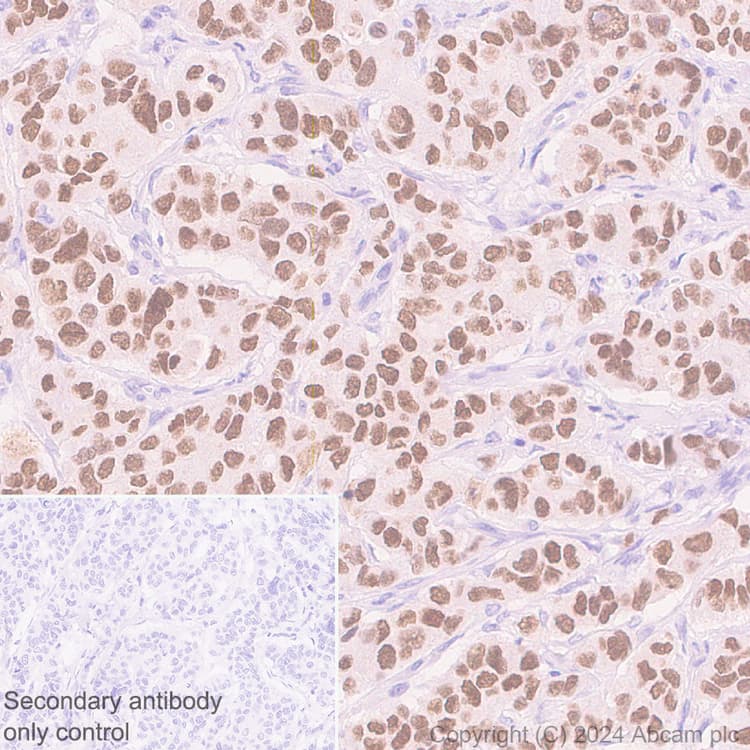 Anti-FOXA1 antibody [RM1119](AB317046)
