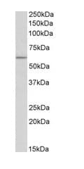 Anti-TPH2 antibody(AB121013)