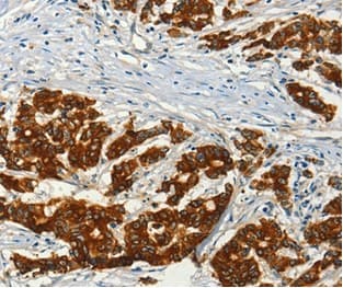 Ac3 Antibody C Terminal Ab199157  Immunohistochemistry Formalin Pfa Fixed Paraffin Embedded Sections Img3634