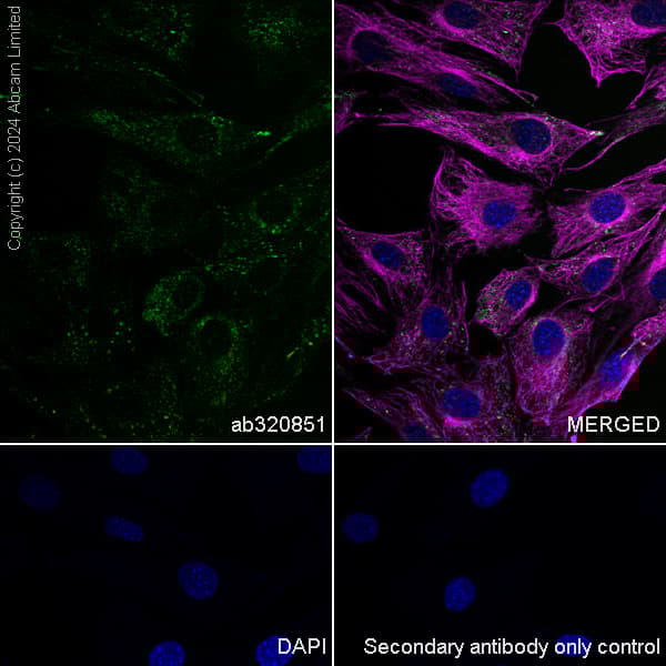 Anti-LAMP1 antibody [RM1217](AB320851)