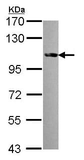 Fes Antibody Ab153841  Western Blot Img148375