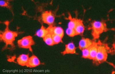 Anti-p75 NGF Receptor antibody [NGFR5](AB3125)