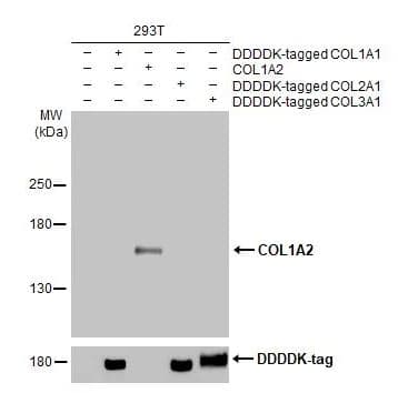 Col1a2 Antibody Hl2049 Ab308221  Western Blot Img407096
