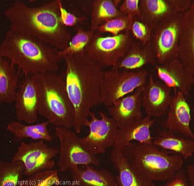 Anti-Cyclophilin B antibody(AB16045)