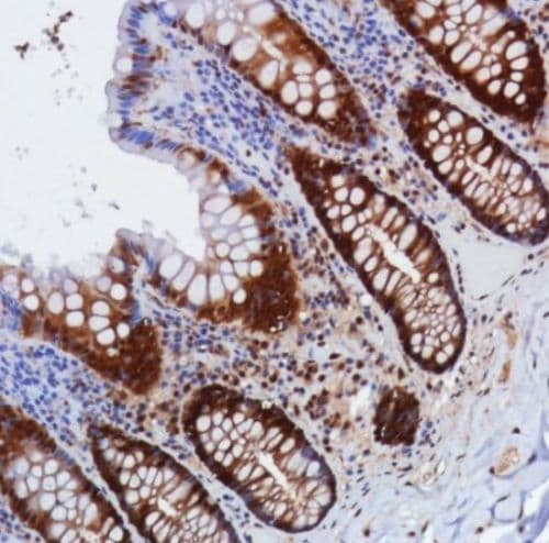 Anti-Smad4 antibody [SP306] - C-terminal, prediluted(AB228205)