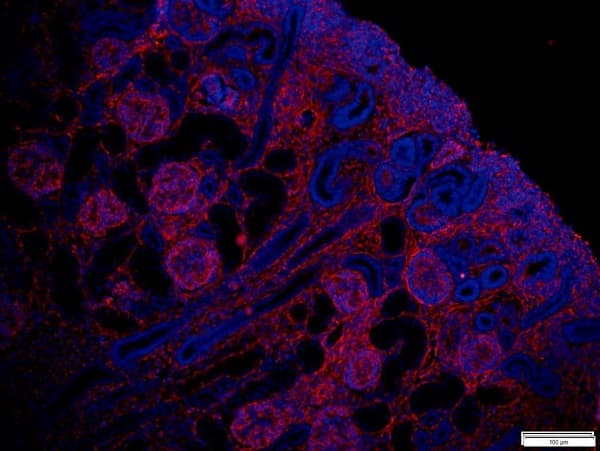 Anti-Vimentin antibody [RV202] - Cytoskeleton Marker(ab8978)