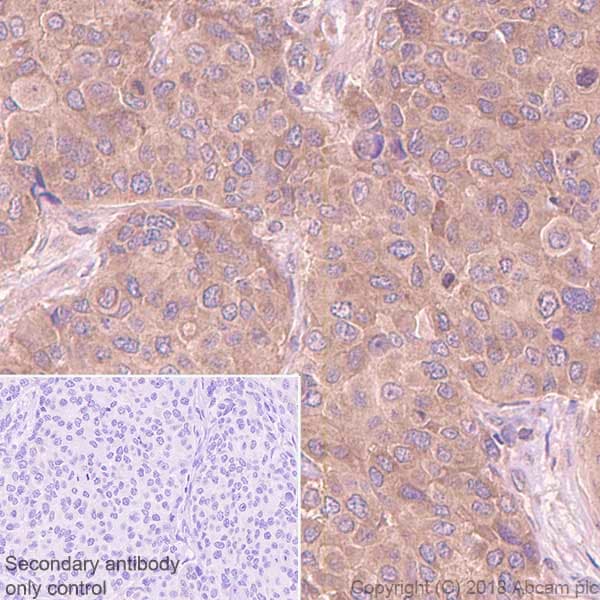 Braf Antibody Ep152y Ab33899  Immunohistochemistry Formalin Pfa Fixed Paraffin Embedded Sections Img71779