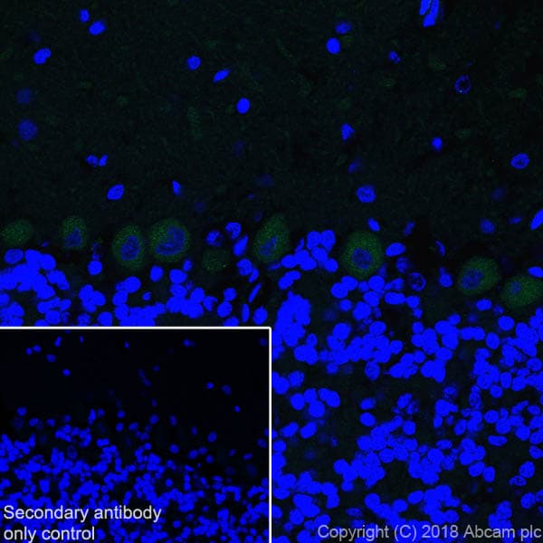 Anti-Ryanodine Receptor antibody [EPR21796](AB219798)