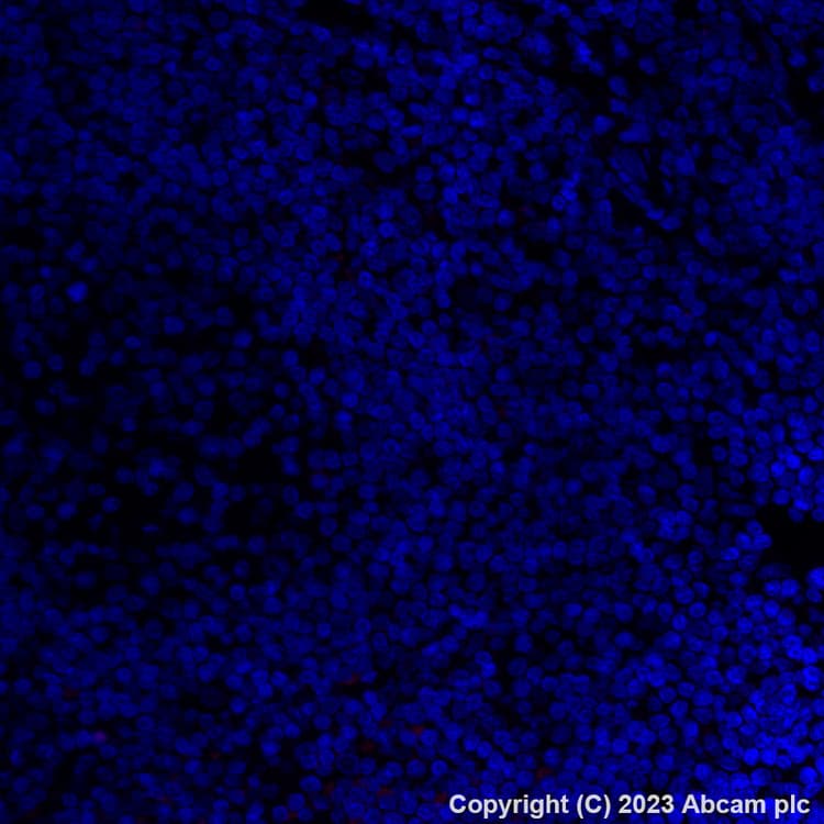 Alexa Fluor® 555 Anti-Folate Binding Protein/FBP antibody [EPR20277](ab309247)