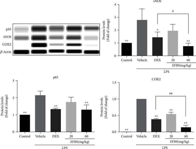 Anti-COX2 / Cyclooxygenase 2 antibody [EPR12012](AB179800)