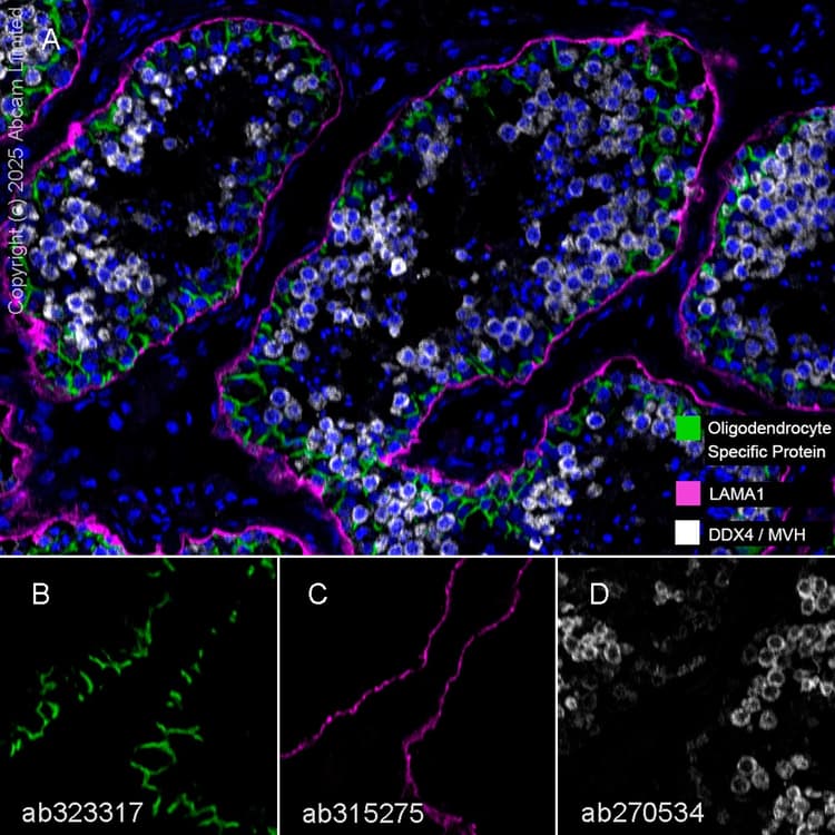 Anti-DDX4 / MVH antibody [EPR24148-58](AB270534)