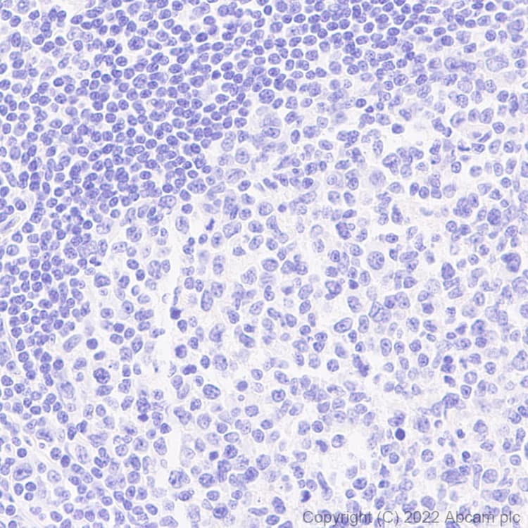 Anti-GFP antibody [EPR14104] - Chicken IgY (Chimeric)(AB300643)