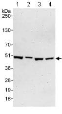 Trip13 Pch2 Antibody Ab128171  Western Blot Img120820