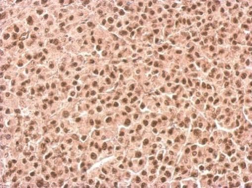 Anti-KMT3A / HYPB / HIF-1 antibody(AB184190)