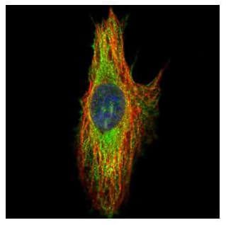 Septin 8 Antibody Ab154112  Immunocytochemistry Immunofluorescence Img95229