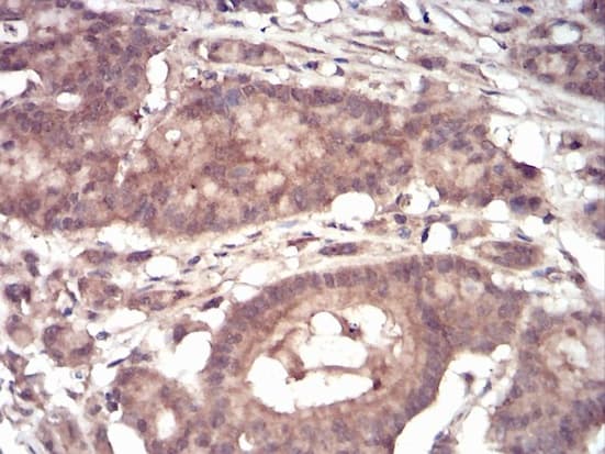 Eif5a Antibody 4e10f6 Ab204939  Immunohistochemistry Formalin Pfa Fixed Paraffin Embedded Sections Img90410