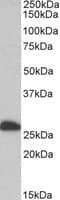 Etfb Antibody Ab104944  Western Blot Img84032
