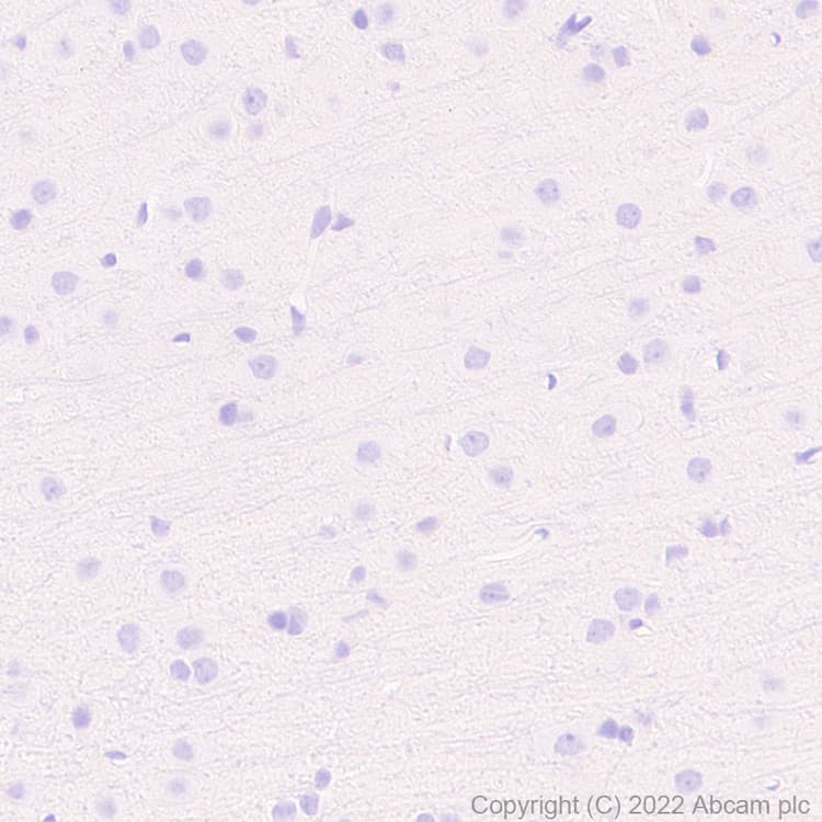Anti-T-bet / Tbx21 antibody [EPR25086-9] - BSA and Azide free(AB300452)