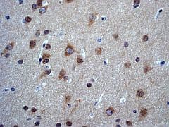 Pkc Zeta Phospho T560 Antibody Ep2037ay Bsa And Azide Free Ab236001  Immunohistochemistry Formalin Pfa Fixed Paraffin Embedded Sections Img90160