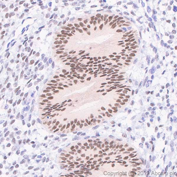 Anti-Estrogen Receptor alpha antibody [E115] - ChIP Grade(ab32063)