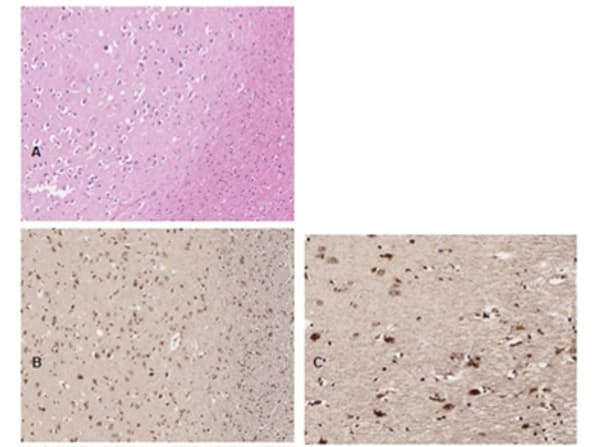 Pi 3 Kinase P85 Alpha Phospho Y607 Antibody Ab235266  Immunohistochemistry Formalin Pfa Fixed Paraffin Embedded Sections Img180908