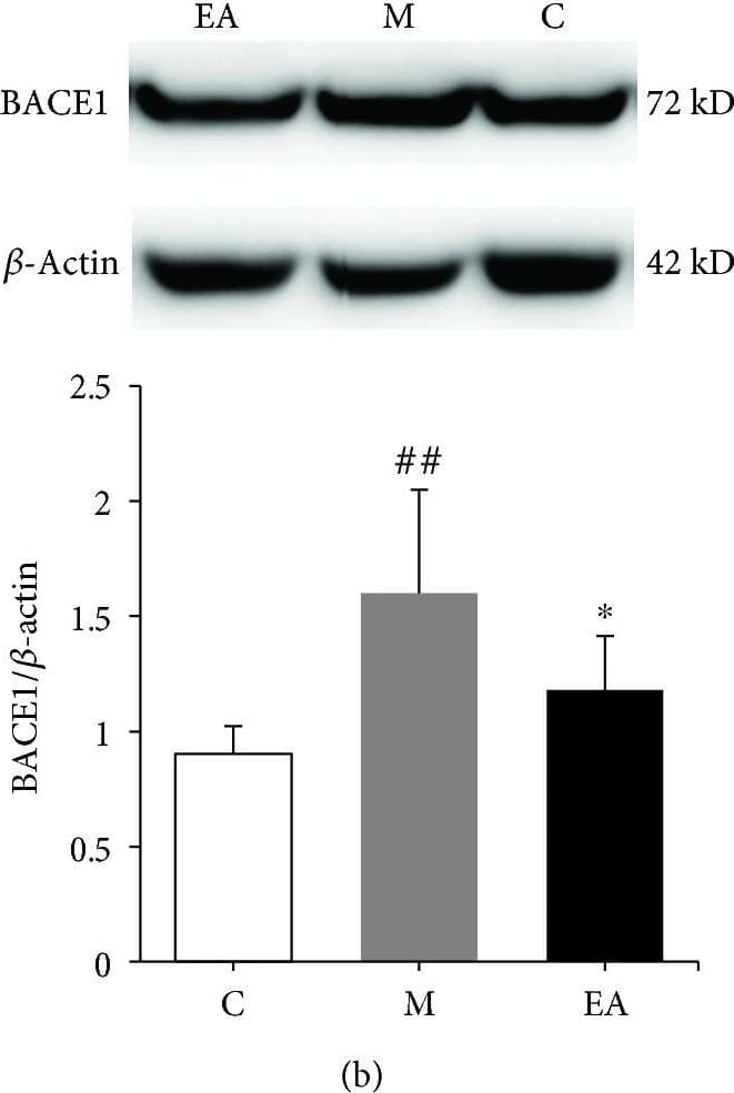 Bace1 Antibody Epr19523 Ab183612  Western Blot Img442868