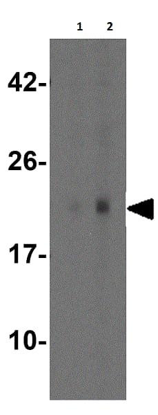 Anti-NRAS antibody(AB167136)