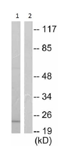 Anti-Bax antibody(AB53154)