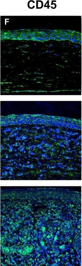 Anti-CD45 antibody(AB10558)