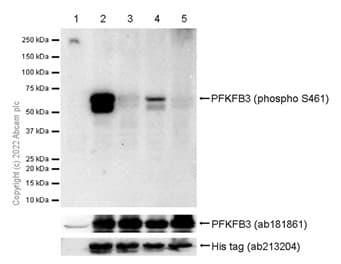 Anti-PFKFB3 (phospho S461) antibody [EPR19735](AB202291)