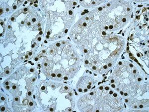 Cdc5l Antibody Epr7658 Bsa And Azide Free Ab248312  Immunohistochemistry Formalin Pfa Fixed Paraffin Embedded Sections Img82104