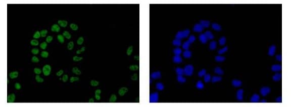 Anti-HIF-1 alpha antibody [EP1215Y](ab51608)