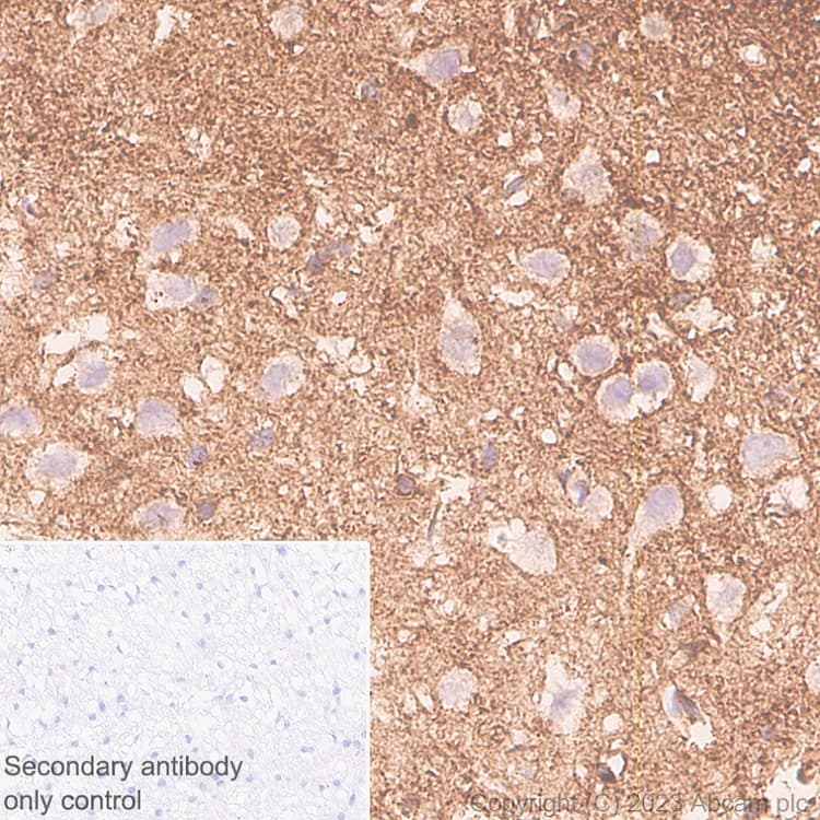 Marcks Antibody Epr28261 90 Bsa And Azide Free Ab315026  Immunohistochemistry Formalin Pfa Fixed Paraffin Embedded Sections Img423775