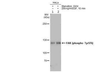 Anti-FAK (phospho Y576) antibody(AB226847)