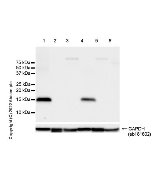 Anti-Calcineurin B/PPP3R1 antibody [EPR24992-18](AB303482)