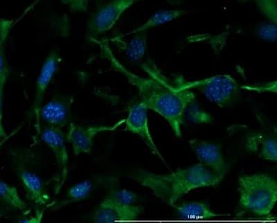 Anti-Collagen IV antibody(AB235296)